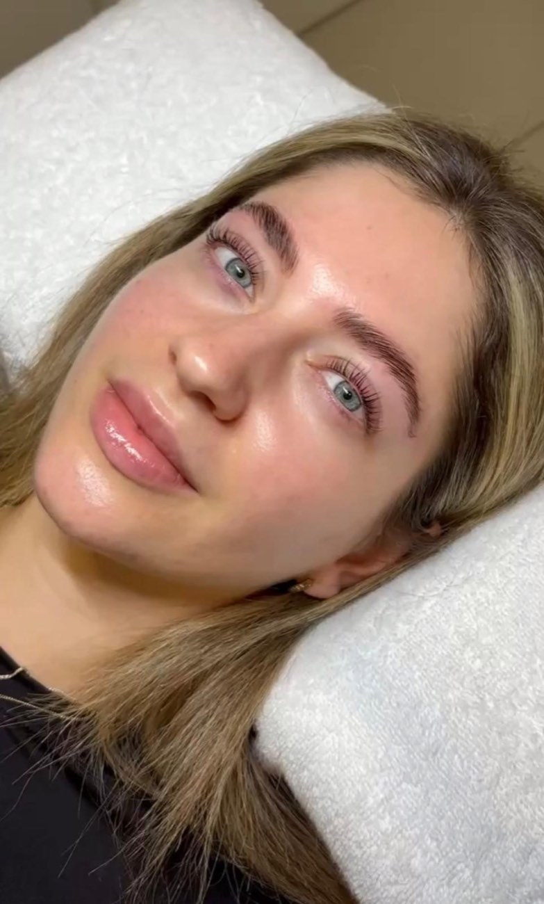 Gelifteter Wimpernschwung und Brauen